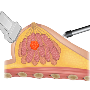 Neocision Illustration 1