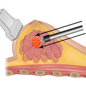 Neocision Illustration 2